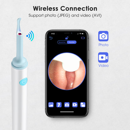 OtoControl 360™ - ¡Deje de limpiar sus oídos a ciegas!👂