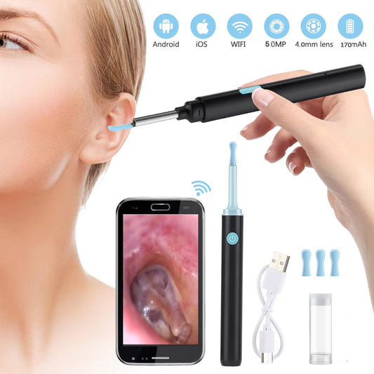 OtoControl 360™ - ¡Deje de limpiar sus oídos a ciegas!👂